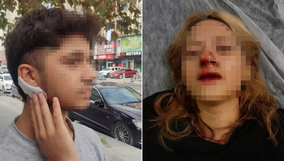 Sultangazi'de genç kıza kaldırım taşlı saldırıya 2 tutuklama