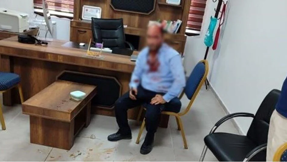 Şanlıurfa'da bir okul müdürü 'demir sopalı' saldırıya uğradı